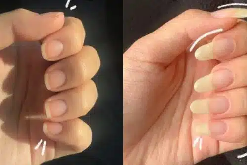 Comment faire pousser les ongles plus vite ?