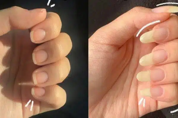 Comment faire pousser les ongles plus vite ?