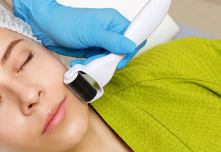 Micro-aiguille : tout sur cette technique anti-âge peau